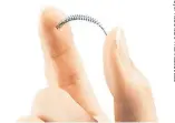  ??  ?? The Essure coil permanent birth control device was taken off the market the week before the release of “The Bleeding Edge.”