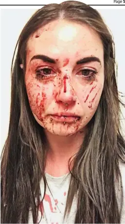  ??  ?? Blood-soaked: Miss Reed after horrific attack by thug