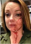  ?? Associated Press ?? ■ This May 6 selfie by Samantha Clarke shows her bruised and bloodied face after she was assaulted by a shopper at the retail store she manages in Modesto, Calif.