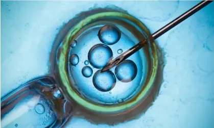  ?? Photograph: nevodka/Alamy ?? The radical procedure. which may take a decade to perfect and approve in humans, could revolution­ise IVF.