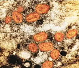  ?? NATIONAL INSTITUTE OF ALLERGY AND INFECTIOUS DISEASES ?? A colorized transmissi­on electron micrograph of monkeypox particles (in orange) found within an infected cell (in brown).