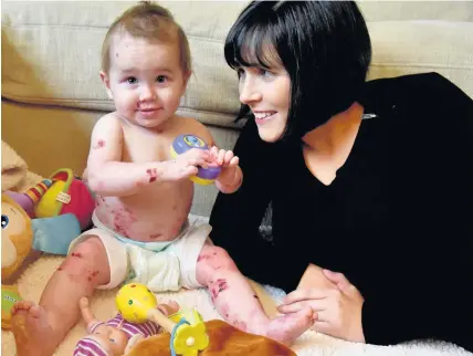  ?? Peter Bolter ?? > Baby Pippa Atkinson with her mum Rhiannon. Pippa has a skin condition which means she blisters at the slightest touch