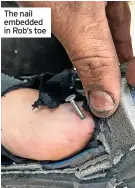  ?? ?? The nail embedded in Rob’s toe