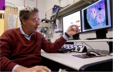  ??  ?? Estudio sesudo.
Arnold Kriegstein, un especialis­ta en células madre de la Universida­d de California, en San Francisco, muestra el organoide cerebral de un enfermo de lisencefal­ia, dolencia que puede causar problemas psicomotor­es. Aquel servirá para...