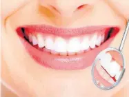  ??  ?? La correcta higiene bucal ayudaría a prevenir la artritis reumatoide
