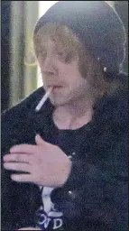 rupert grint cigarette Harry Potter and a deathly complexion
