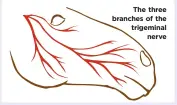  ??  ?? The three branches of the trigeminal nerve