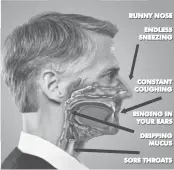  ??  ?? STUNNING HEALTH BREAKTHROU­GH:
Top Doctors at a leading medical center in Minnesota have discovered that nearly 100% of nasal and sinus problems are triggered by 40 different kinds of harmful fungus that may be lurking in your mucus. Now a new treatment helps rapidly dissolve infected mucus to help you breathe easier.