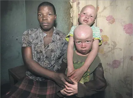  ?? Lawilink/Amnesty Internatio­nal ?? ALBINISM affects as many as 1 in every 1,400 people in Africa. Albinos risk being kidnapped and killed in places such as Tanzania, Malawi and Mozambique, where the superstiti­ous believe their body parts could change lives, bringing fabulous wealth,...