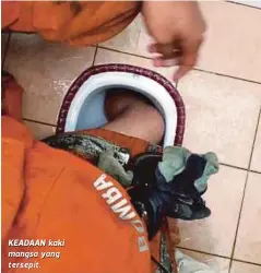  ??  ?? KEADAAN kaki mangsa yang tersepit.