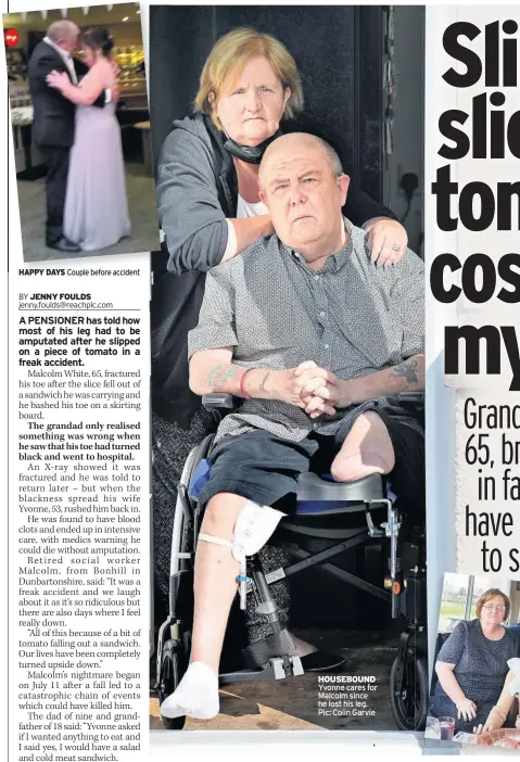  ??  ?? HAPPY DAYS Couple before accident
HOUSEBOUND Yvonne cares for Malcolm since he lost his leg. Pic: Colin Garvie