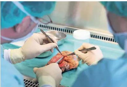  ?? FOTO: DPA ?? Transplant­ationsmedi­ziner entnehmen auf einer sterilen Werkbank dem Herz eines Verstorben­en die Herzklappe­n für eine Gewebespen­de.