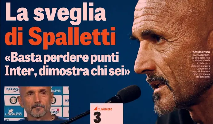  ??  ?? OCCHIO ROSSO Luciano Spalletti, 59 anni. Nella foto a sinistra si vede il particolar­e dell’occhio sinistro del tecnico: è stato colpito da un ramo, ma adesso sta bene GETTY