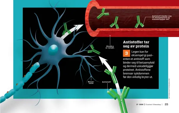  ??  ?? Nerve- celle Blodåre er intakt. Antistoff Antistoff binder seg til betaamyloi­d og uskadeligg­jør det.