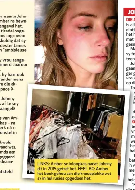  ??  ?? LINKS: Amber se inloopkas nadat Johnny dit in 2015 getref het. HEEL BO: Amber het boek gehou van die kneusplekk­e wat sy in hul rusies opgedoen het.