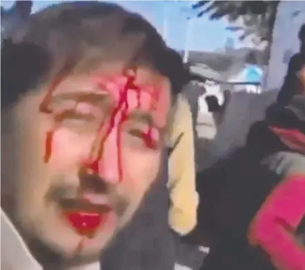  ??  ?? A man in Afghanista­n claiming to be an Australian citizen with blood on his face. Picture: Twitter