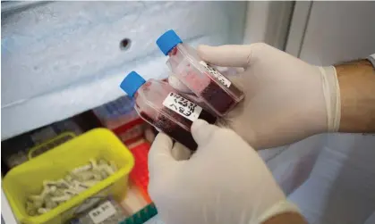  ?? ?? Thousands of patients a year could benefit from the NHS screening programme for the hepatitis C virus. Photograph: Phanie/Alamy