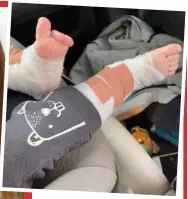  ??  ?? Cool under pressure: Archie, with mum Laura and, inset, Archie’s feet, bandaged for his trip home from hospital