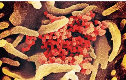  ?? FOTO: DPA ?? Die Aufnahme mit dem Elektronen­mikroskop zeigt das neuartige Coronaviru­s Sars-CoV-2 (orange), wie es aus der Oberfläche von im Labor kultiviert­en Zellen (grau) austritt.