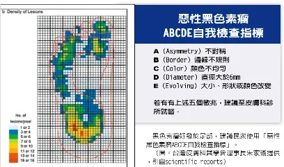 5指標腳底黑點恐是惡瘤 Pressreader