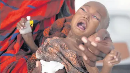  ??  ?? > Little girl Hamdi Ahmed was suffering from complicati­ons caused by malnourish­ment. Since this picture was taken, Hamdi has died