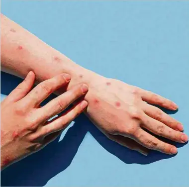  ?? Photo: Shuttersto­ck ?? Un premier cas d'une femme contaminée par le virus a été enregistré en Belgique.