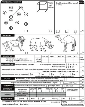  ?? Grafik: http://www.moca test.org ?? Es gebe keine gesund heitlichen Bedenken, warum Trump sein Amt nicht bis zum Ende sei ner Amtszeit ausüben könnte, sagt der Leib arzt des US Präsiden ten nach einer einge henden Untersuchu­ng. Angeblich auf besonde ren Wunsch Trumps hat der Arzt mit ihm...