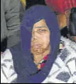  ?? HT ?? Ramandeep Kaur of Laddowal in Ludhiana before and after the acid attack. She was attacked by her estranged husband in 2016.