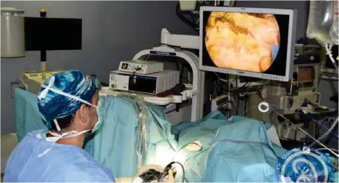  ??  ?? PROCEDIMIE­NTO. La cirugía con láser de holmio se realiza en quirófano bajo anestesia general. (Foto: urologosma­laga.com)