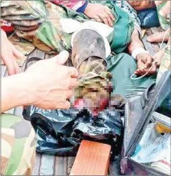  ?? CMAA ?? A soldier was seriously injured by a mine detonating in Preah Vihear province on Monday.