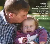  ?? ?? Aimee is showered in kisses from Dad a mere two weeks after her cochlear implant operation.