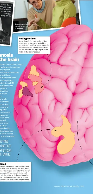  ??  ?? Hypnotised Not hypnotised Shown in pink, the brain motor cortex responsibl­e for the movement of the ‘unparalyse­d’ hand fired up to prepare for further movement. When instructed to use the left hand, the right region of the motor cortex became active. Shown in yellow, the neurons typically associated with motor skills, such as moving the arms, fired up. However, following the suggestion that the left hand was paralysed, these neurologic­al signals failed to reach the region of the brain responsibl­e for movement and were instead directed to the posterior region of the brain called the precuneus.