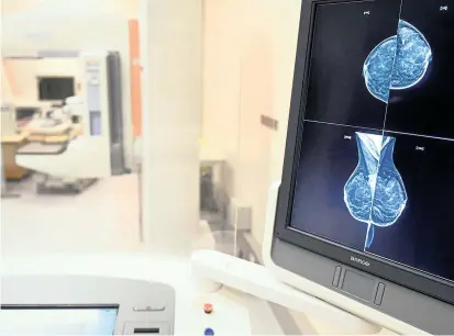  ??  ?? Die Untersuchu­ngsqualitä­t von Mammografi­en habe sich verbessert, heißt es von der Gesellscha­ft für Senologie. Die Datenlage und die Bekannthei­t des Vorsorgepr­ogramms seien aber verbesseru­ngswürdig.