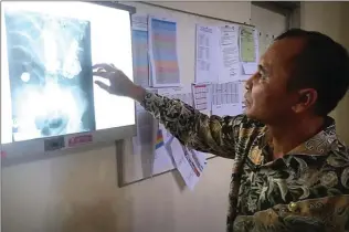  ?? RSUD SITUBONDO FOR JAWA POS RADAR BANYUWANGI ?? BERSARANG DI PERUT: Hasil rontgen menunjukka­n sejumlah benda tajam berada di dalam perut Hendro kemarin.