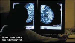  ??  ?? Breast cancer victims face radiothera­py risk