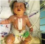  ?? ?? Trauma...Bobby in hospital as a baby. He was born with rare heart condition