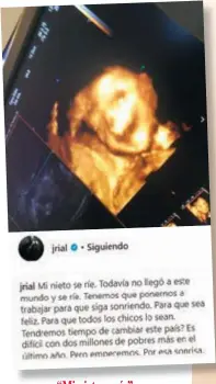  ??  ?? “Mi nieto se ríe” Rial fue con More, Facundo, Rocío, Romina y sus hijas a ver la ecografía 5D. “Lo compartimo­s en familia”,relata Jorge con alegría.