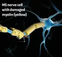  ?? ?? MS nerve cell with damaged myelin (yellow)
