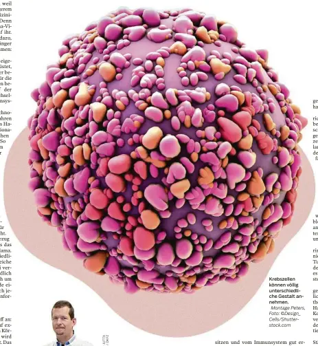  ??  ?? Krebszelle­n können völlig unterschie­dliche Gestalt annehmen. Montage Peters, Foto: ©Design_ Cells/shuttersto­ck.com