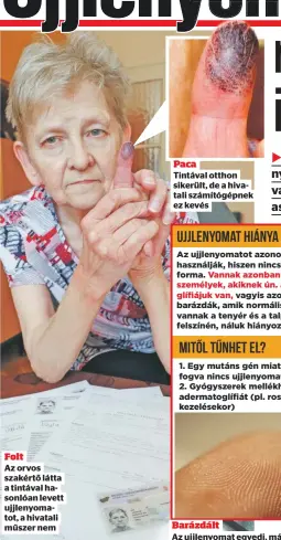  ??  ?? Folt
Az orvos szakértő látta a tintával hasonlóan levett ujjlenyoma­tot, a hivatali műszer nem
Paca
Tintával otthon sikerült, de a hivatali számítógép­nek ez kevés
Barázdált
Az ujjlenyoma­t egyedi, már akinek van