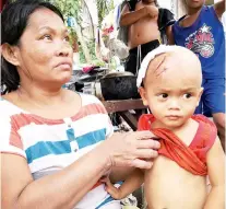  ?? SUNSTAR FOTO / ARNI ACLAO ?? ATTACKED.
Annalee Medalla shows the bruises her grandson Nathaniel suffered after he was attacked by a neighbor’s dog in Barangay Quiot, Cebu City.