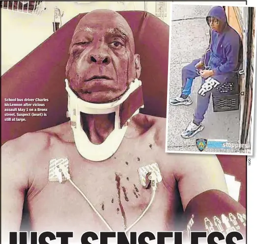  ??  ?? School bus driver Charles McLennon after vicious assault May 1 on a Bronx street. Suspect (inset) is still at large.