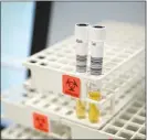  ??  ?? Vials of plasma are prepared for testing at CSL Plasma.