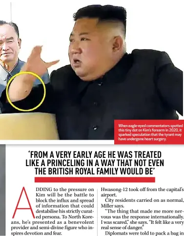  ?? ?? When eagle-eyed commentato­rs spotted this tiny dot on Kim’s forearm in 2020, it sparked speculatio­n that the tyrant may have undergone heart surgery.