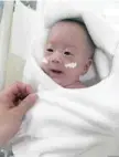  ?? — AFP ?? After five months of treatment, the baby boy now weighs 3.238 kilos, is feeding normally and has been discharged from Keio University Hospital.