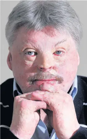  ??  ?? Falklands War veteran Simon Weston has revealed he still feels ‘incredibly lucky’ to be alive