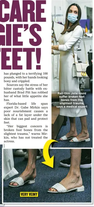 ?? ?? VERY VEINY
Rail-thin Jolie could suffer broken foot bones from the slightest trauma, says a medical expert