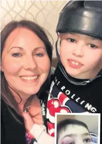  ??  ?? Joanne Griffiths with Ben, left, in his safety helmet and, inset, the seizures can injure him