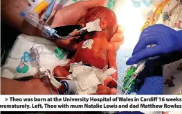  ?? ?? Theo was born at the University Hospital of Wales in Cardiff 16 weeks prematurel­y. Left, Theo with mum Natalie Lewis and dad Matthew Rowles