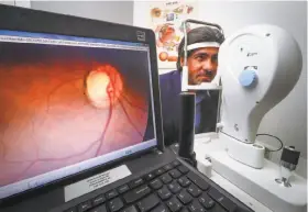  ?? Tony Avelar / Special to The Chronicle ?? Dr. Jorge Cuadros takes an image of his retina. He has provided Google with similar images of patients’ eyes to help the company develop its technology.